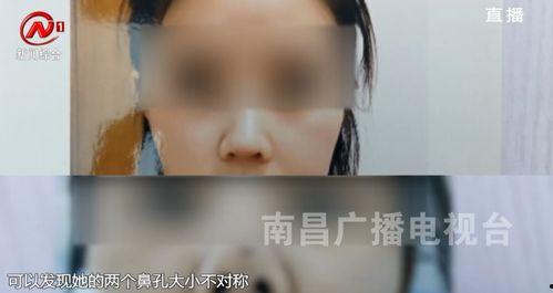 南昌医美爆料事件视频,行业乱象引发公众关注  第2张